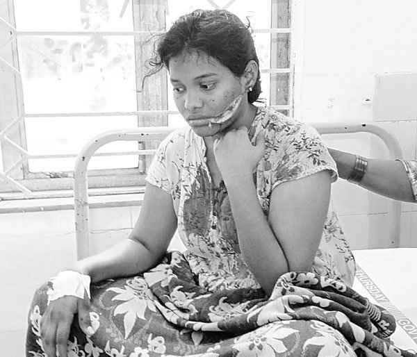 West Godavari : రెచ్చిపోయిన ప్రేమోన్మాది..ప్రేయసితో పాటు తల్లి, చెల్లిపై కత్తితో దాడి 3 west-godavari-boy-attacked-with-knife-on-girl-and-girl-family
